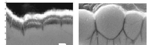 嚴重鎳腐蝕切片 嚴重鎳腐蝕切片